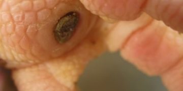 gà bị sưng củ bàn