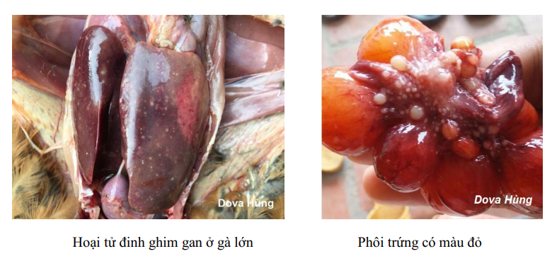 bệnh tích bệnh thương hàn